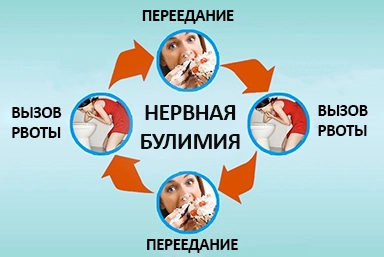 Лечение булимии в Мамедкале